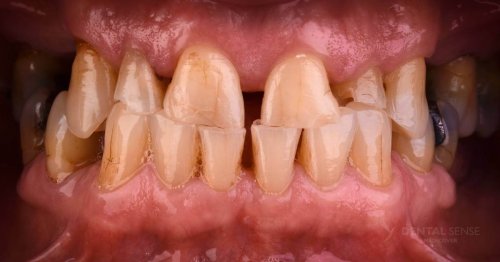 DSM_Metamorfoza_061_IMG_03