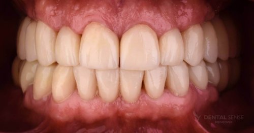 DSM_Metamorfoza_061_IMG_04