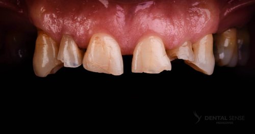 DSM_Metamorfoza_061_IMG_05