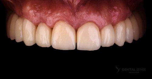 DSM_Metamorfoza_061_IMG_06