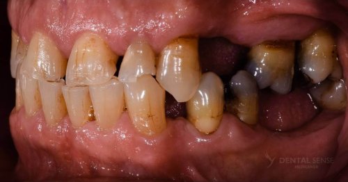 DSM_Metamorfoza_061_IMG_07