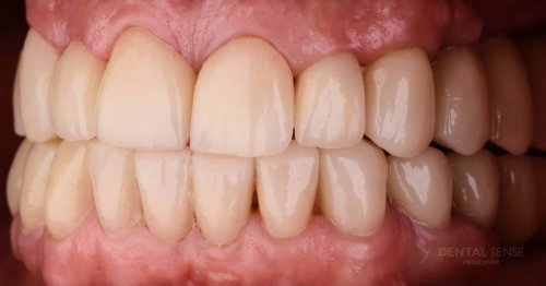 DSM_Metamorfoza_061_IMG_08