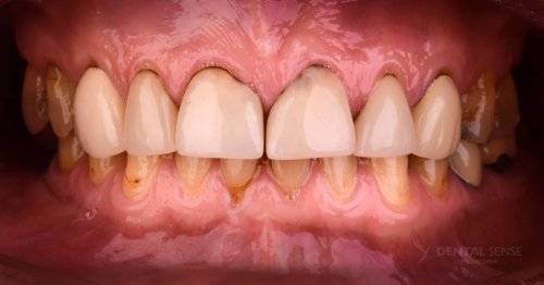 DSM_Metamorfoza_062_IMG_03