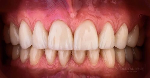 DSM_Metamorfoza_062_IMG_04