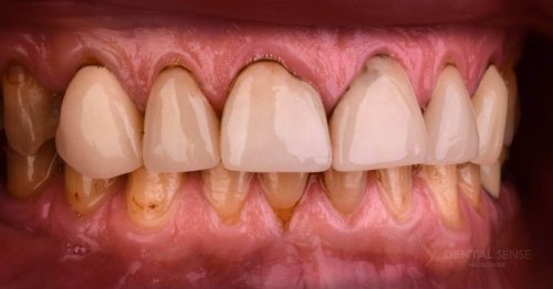 DSM_Metamorfoza_062_IMG_05