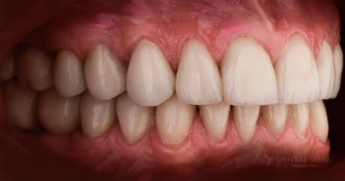 DSM_Metamorfoza_062_IMG_06