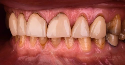 DSM_Metamorfoza_062_IMG_07