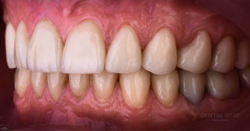 DSM_Metamorfoza_062_IMG_08