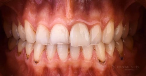 DSM_Metamorfoza_063_IMG_03