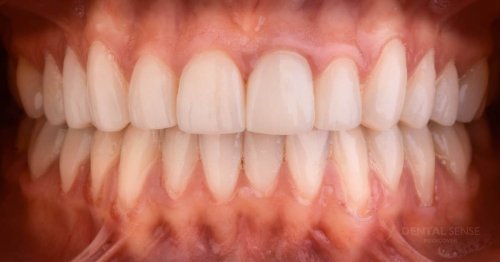 DSM_Metamorfoza_063_IMG_04