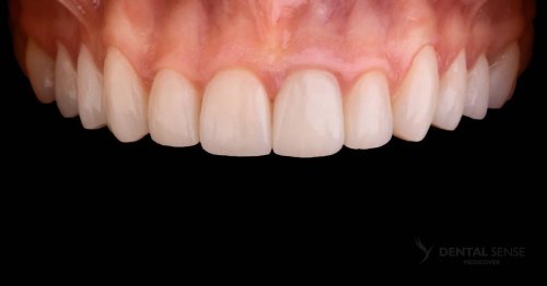 DSM_Metamorfoza_063_IMG_06