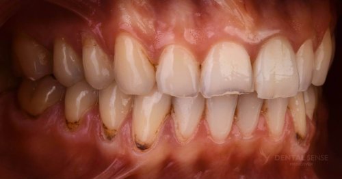 DSM_Metamorfoza_063_IMG_07