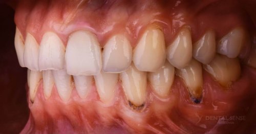 DSM_Metamorfoza_063_IMG_09