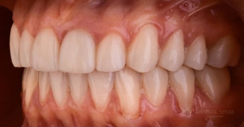 DSM_Metamorfoza_063_IMG_10