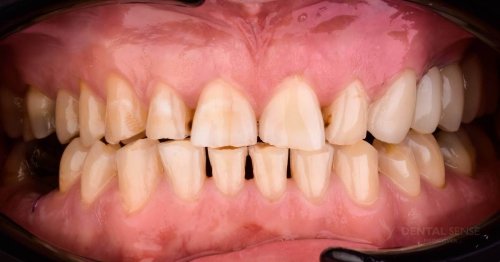 DSM_Metamorfoza_069_IMG_03