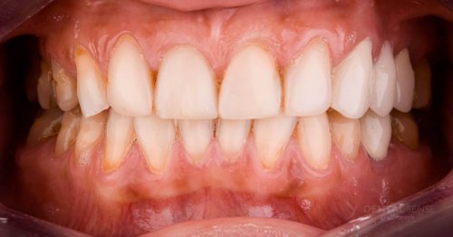 DSM_Metamorfoza_085_IMG_03