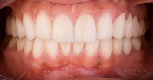 DSM_Metamorfoza_085_IMG_04