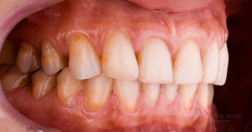 DSM_Metamorfoza_085_IMG_05