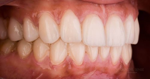 DSM_Metamorfoza_085_IMG_06