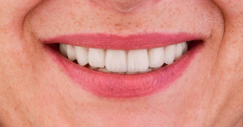 DSM_Metamorfoza_085_IMG_08