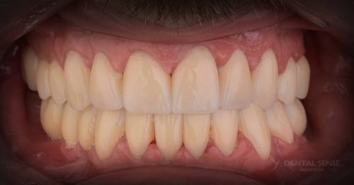 DSM_Metamorfoza_097_IMG_04