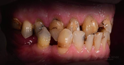 DSM_Metamorfoza_097_IMG_05