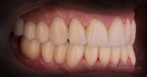 DSM_Metamorfoza_097_IMG_06