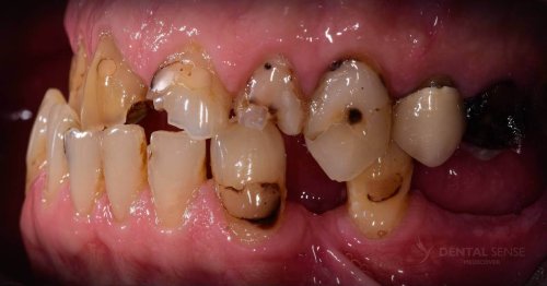 DSM_Metamorfoza_097_IMG_07