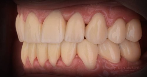 DSM_Metamorfoza_097_IMG_08