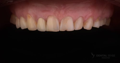 DSM_Metamorfoza_099_IMG_03