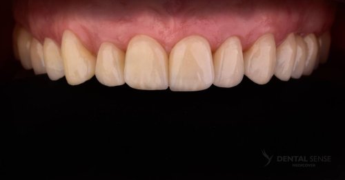 DSM_Metamorfoza_099_IMG_04