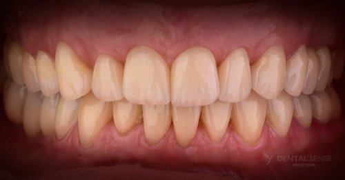 DSM_Metamorfoza_099_IMG_05