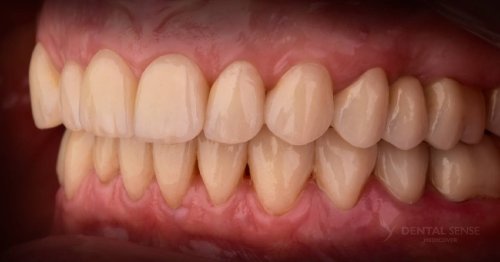 DSM_Metamorfoza_099_IMG_06