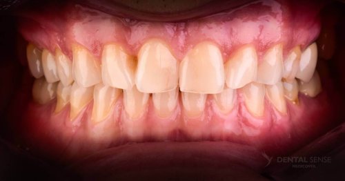 DSM_Metamorfoza_100_IMG_03