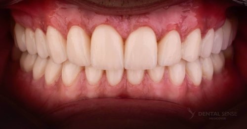 DSM_Metamorfoza_100_IMG_04