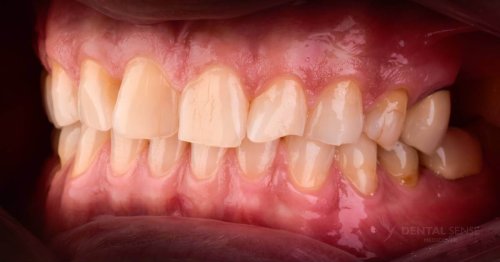 DSM_Metamorfoza_100_IMG_05