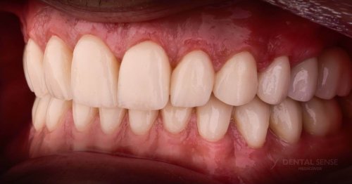 DSM_Metamorfoza_100_IMG_06