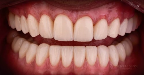 DSM_Metamorfoza_100_IMG_07