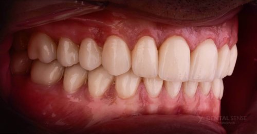 DSM_Metamorfoza_100_IMG_08