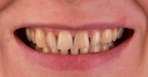 DSM_Metamorfoza_103_IMG_03