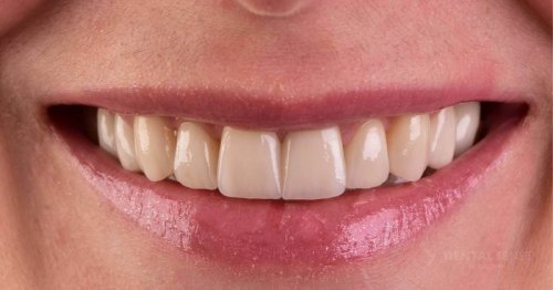 DSM_Metamorfoza_103_IMG_04