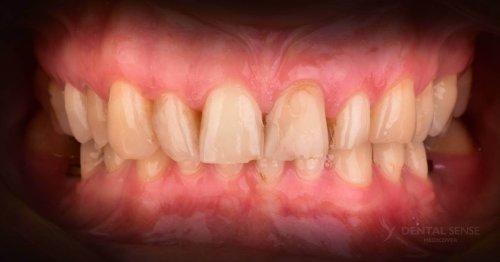 DSM_Metamorfoza_103_IMG_05