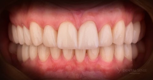 DSM_Metamorfoza_103_IMG_06