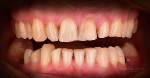 DSM_Metamorfoza_103_IMG_07