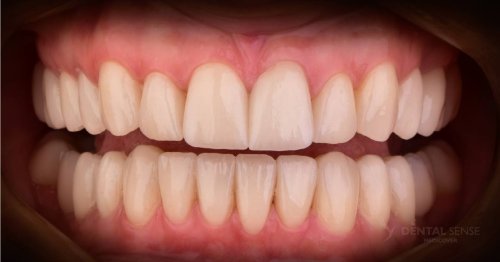 DSM_Metamorfoza_103_IMG_08