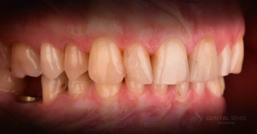 DSM_Metamorfoza_103_IMG_09