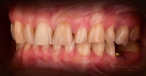 DSM_Metamorfoza_103_IMG_11