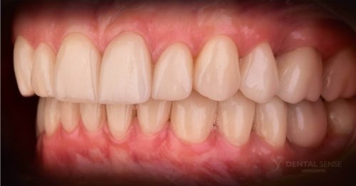 DSM_Metamorfoza_103_IMG_12