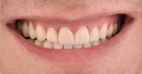 DSM_Metamorfoza_105_IMG_04