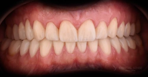 DSM_Metamorfoza_105_IMG_06